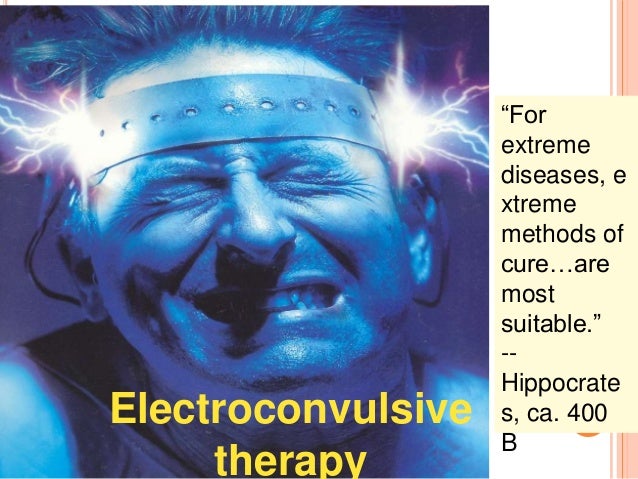 electroconvulsive-therapy-ect-2-638.jpg