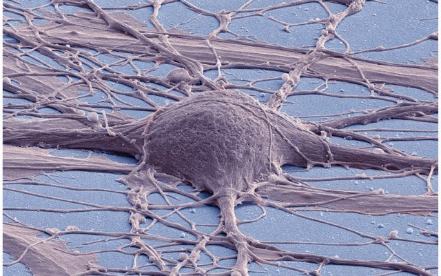 human+neuron+from+induced+pluripotent+stem+cells.jpg
