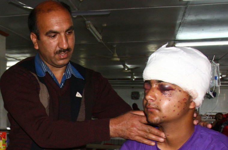 Kashmir-protester-blinded.jpg