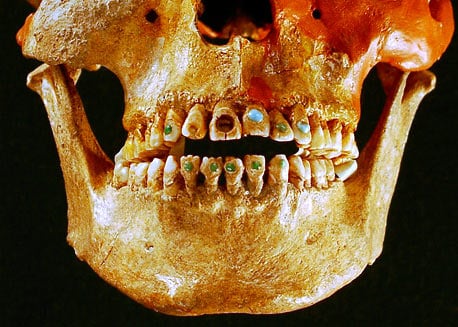 mayan-dental-bling.jpg