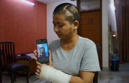 Nancy Chingthianniang was attacked and injured by a mob in Manipur
