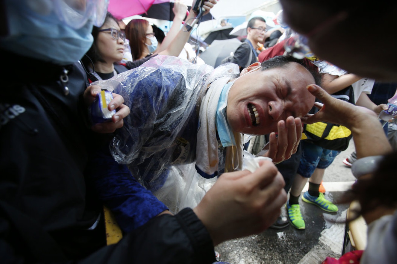 A pro-democracy demonstrator was overcome after police used pepper spray..jpg