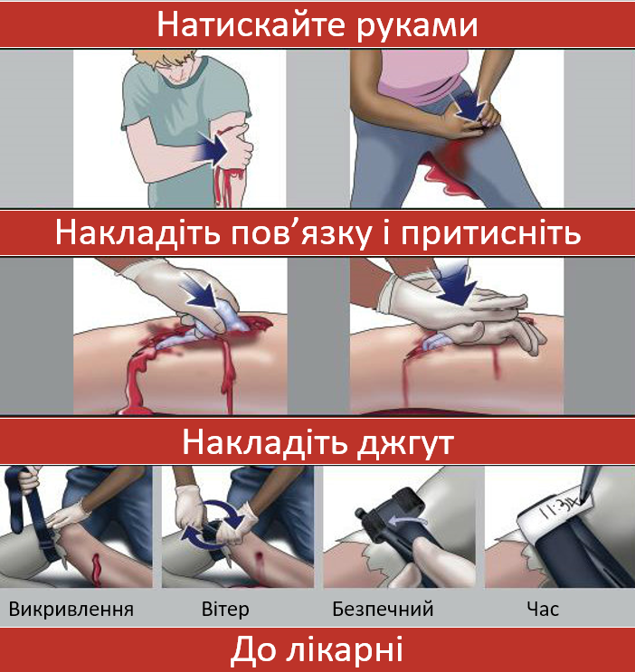 Guide for Help - Stop the Bleed UKR.png