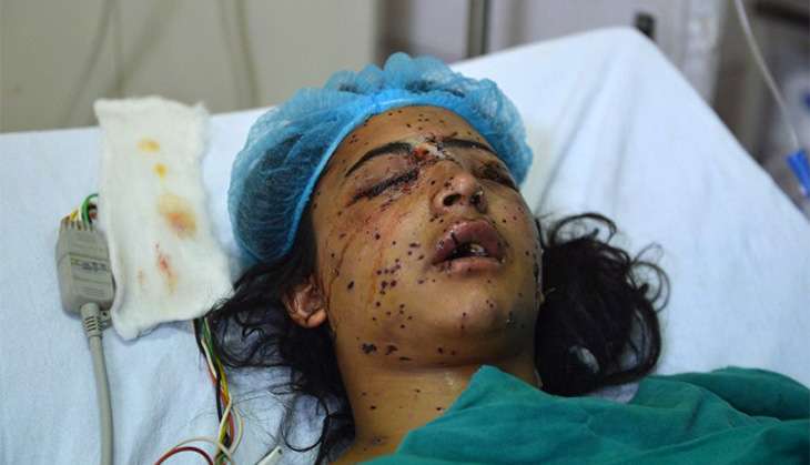 Kashmir-Young-girl-blinded-by-pellets-fired-by-Indian-security-forces.jpg