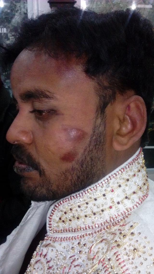 MQM-Worker-Fahad-Aziz-Torture-By-Police (9).jpg