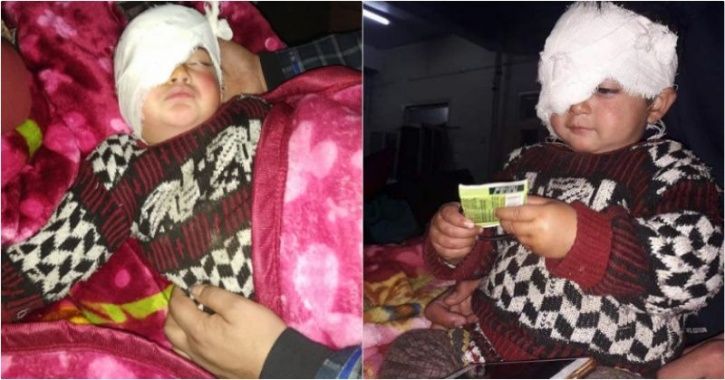 19monthold_heeba_is_the_youngest_victim_of_pellet_guns_in_kashmir_may_lose_sight_1543298081_725x725.jpg
