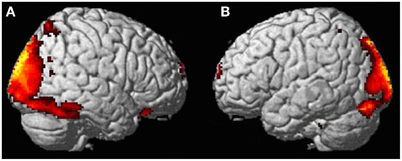 Scientists_Scanned_A_Woman%27s_Brain-5649f42d4a36cbfe88dc34614841d968