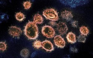 Coronavirus was in US in mid-December last year, study suggests