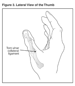 Fig3_Thumb.gif