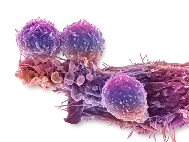 C0288779-Cancer_cell_and_T_lymphocytes%2C_SEM-SPL_WEB.jpg