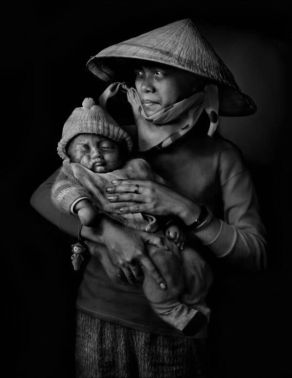 A mother in Hanoi with a child showing the effects of Agent Orange in 2015.