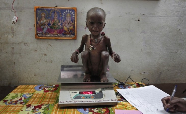 1374844966_malnourished-child.jpg