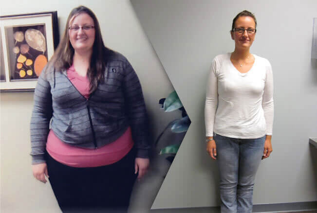 gastric-bypass-before-and-after-women4.jpg