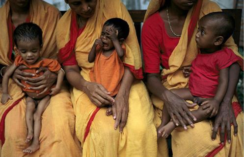 malnourished-children-dhaka__bangladesh-497x321.jpg