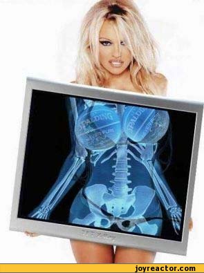 funny-pictures-auto-pamela-anderson-x-ray-378695.jpeg