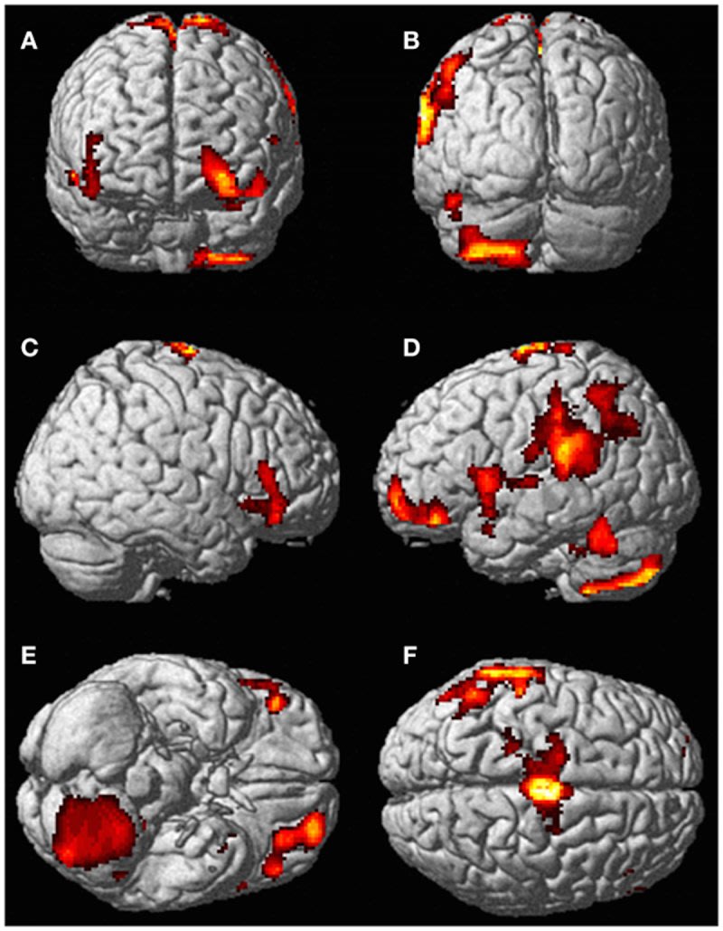 Scientists_Scanned_A_Woman%27s_Brain-d406f50b2948df9924612bfe89332a54