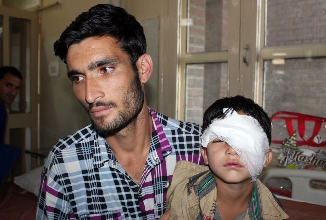 pellet-india-kashmir2.jpg