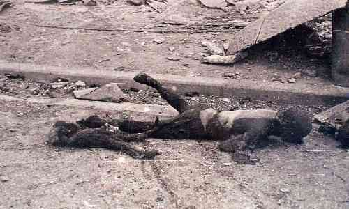 japanese-atomic-bomb-victims-43.jpg