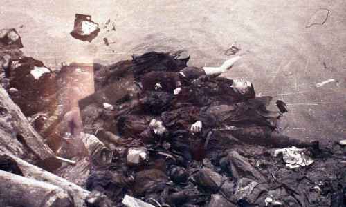 japanese-atomic-bomb-victims-36.jpg