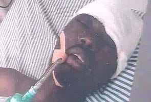 Burundi_student_attacked_295.jpg