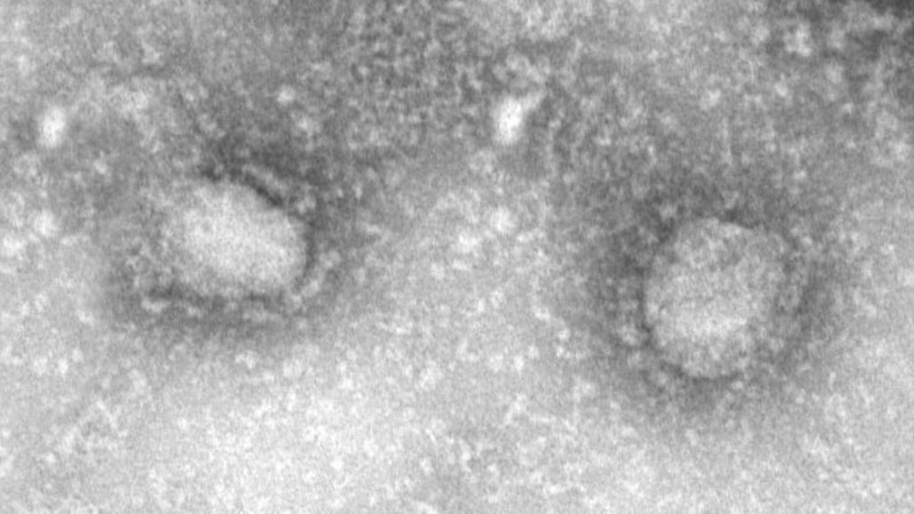 012420_ts_coronavirus_feat.jpg