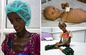 composite-starving-in-yemen.jpg
