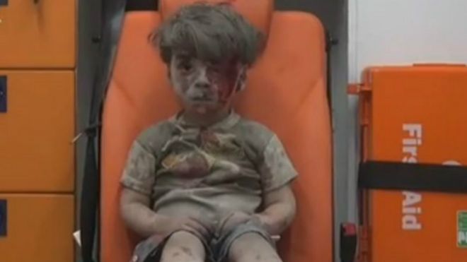 160818104423_omran_daqneesh_syria_640x360_aleppomediacenter_nocredit.jpg