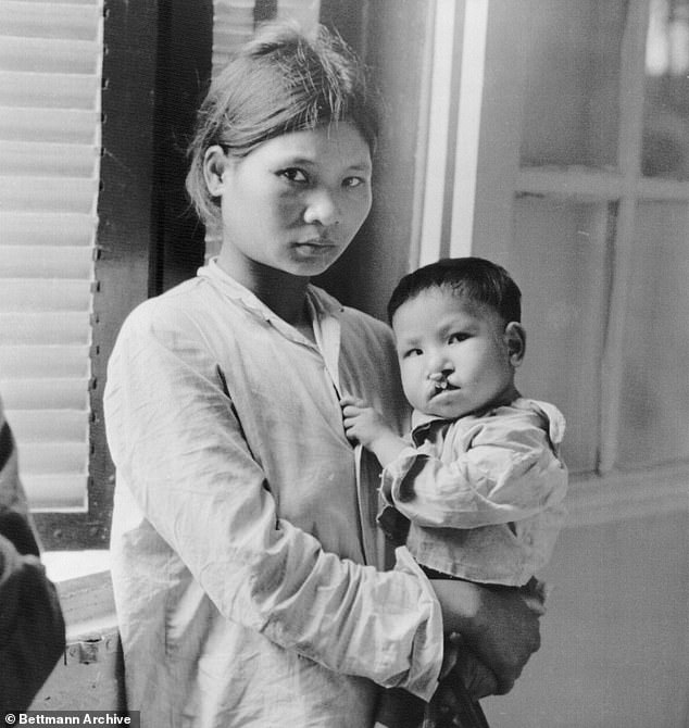 Agent Orange was the most devastating and enduring blight inflicted on Vietnam during the conflict, believed to have caused death or serious injury to up to a million victims (pictured, a mother holds her daughter while waiting to be treated for birth defects in hospital in Hanoi)