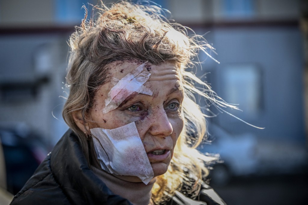 A wounded woman stands outside a hospital after the bombing of the eastern Ukraine town of Chuguiv