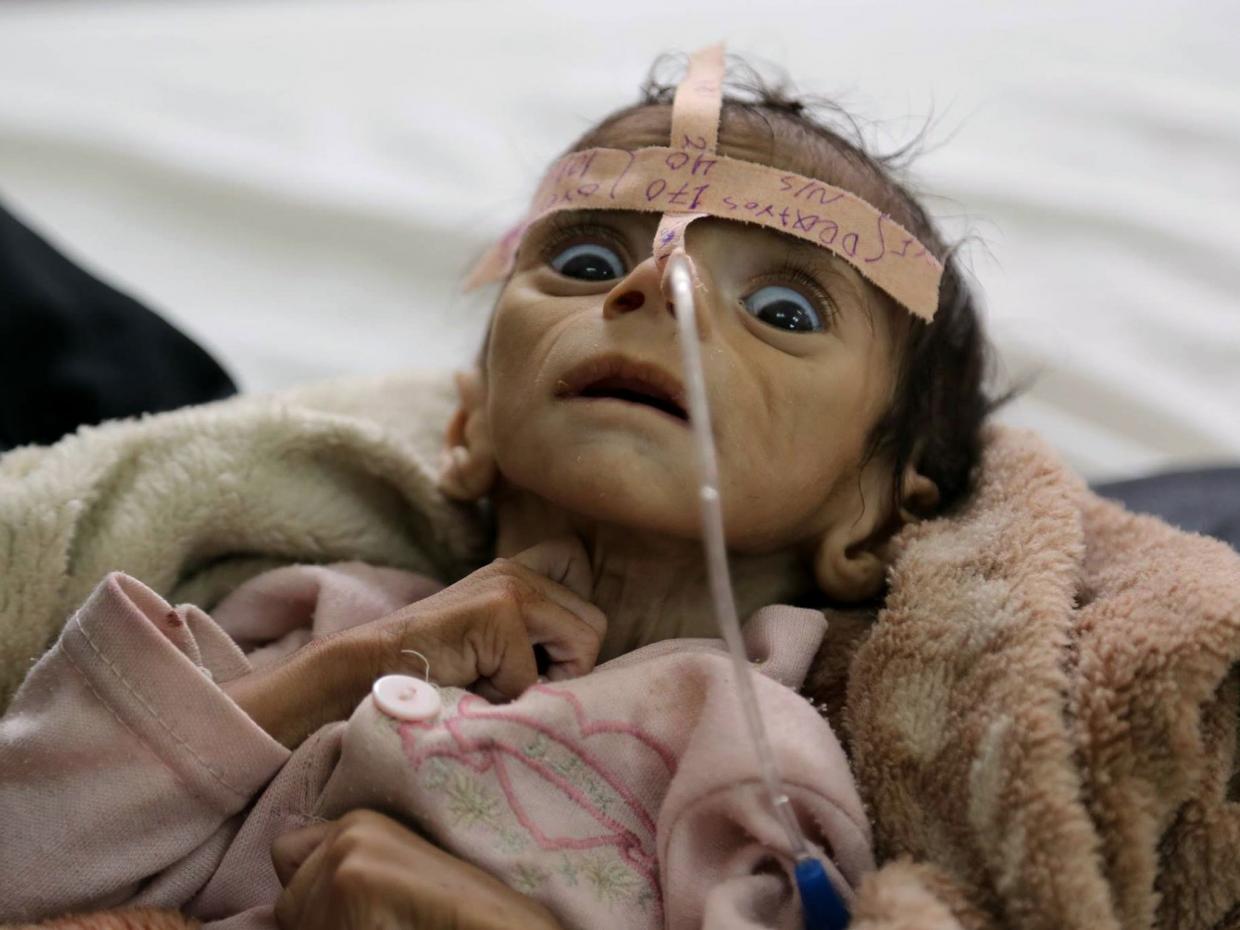 starving-baby-yemen.jpg