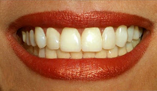 teeth-stem-cells.jpg