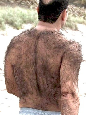 hairy+back.jpg