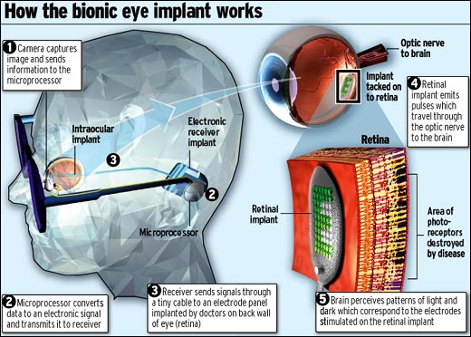 bionic-eye.jpg